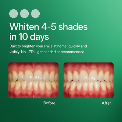 Modora™ Pro Whitening Trays